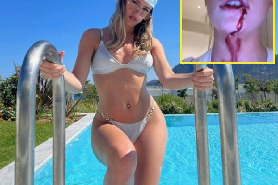 PRETI MU ZATVOR Zvezda Junajteda pretukla devojku jer nije htela seks! Ona pokazala krv i podlive