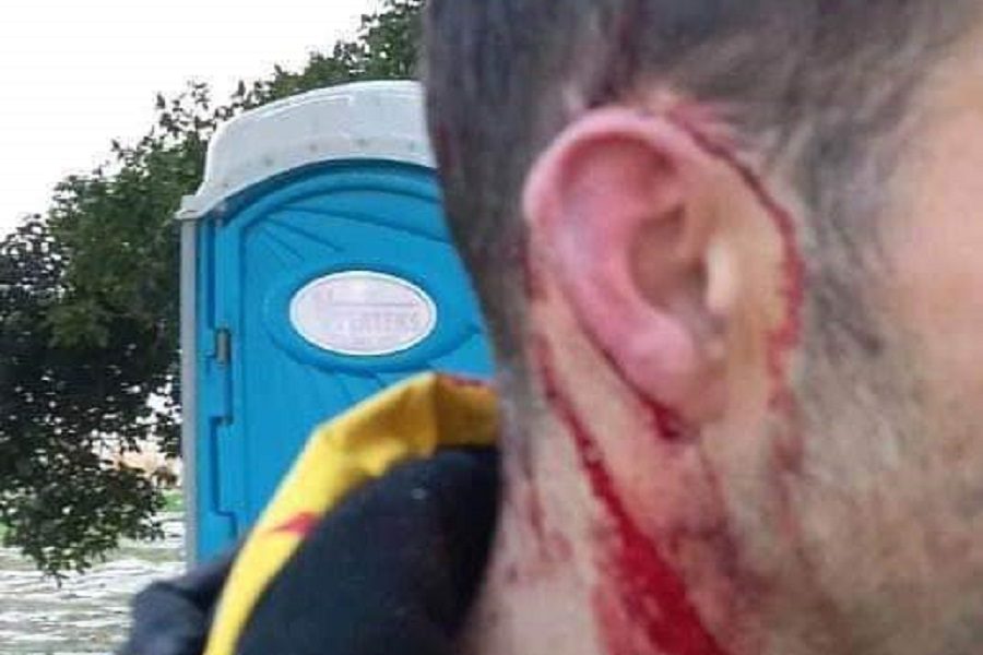 EKSKLUZIVNO Skandal u Zadru! Pripadnici „tornada“ pre meča prebili navijača Zvezde… Nije imao klupska obeležja, napali ga zbog govora!